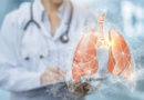 Hipertensión Arterial Pulmonar, una enfermedad grave que puede tardar más de dos años en diagnosticarse